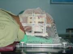 radioterapi4